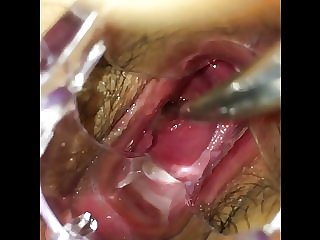 Japanese cervix playing